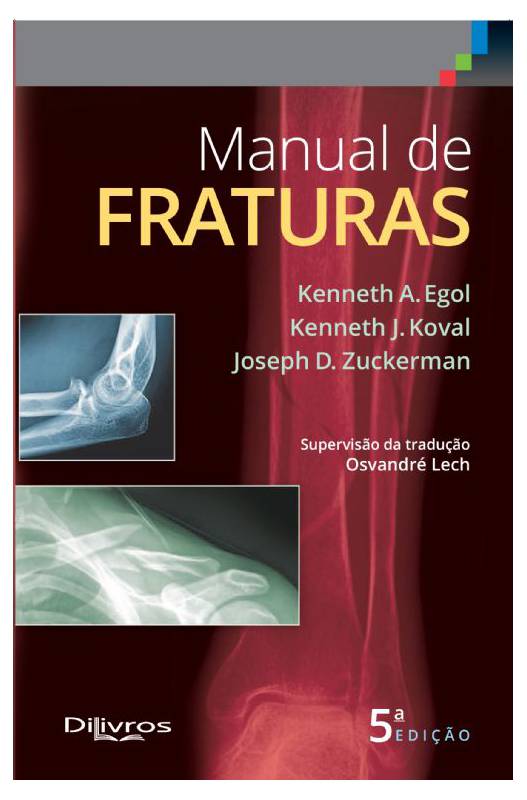 Livro Manual De Fraturas Kenneth A Egol Kenneth J Koval Joseph D