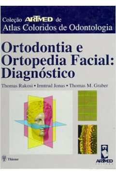 Ortodontia e Ortopedia Facial: Diagnóstico