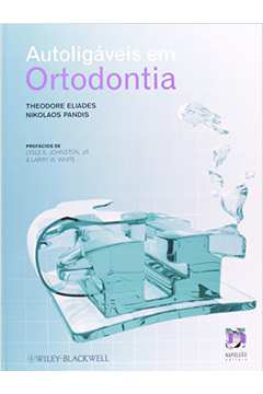 Autoligaveis Em Ortodontia
