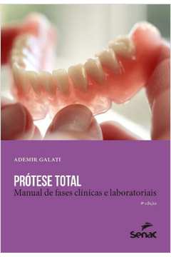 Prótese Total: Manual de Fases Clínicas e Laboratoriais