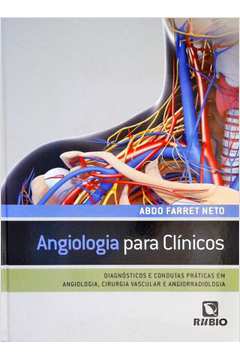 Angiologia para Clinicos