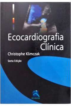 Ecocardiografia Clínica