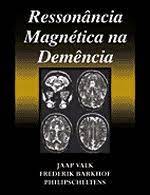 Ressonância Magnética na Demência