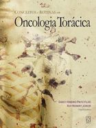 Conceitos e Rotinas Em Oncologia Torácica