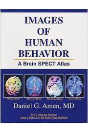 O Cérebro Está Sempre à Escuta, Dr. Daniel G. Amen - Pergaminho