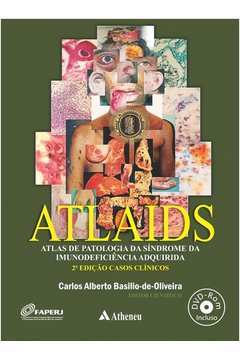 Atlaids - Atlas de Patologia da Síndrome da Imunodeficiência Adquirida