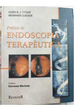 Prática de Endoscopia Terapêutica