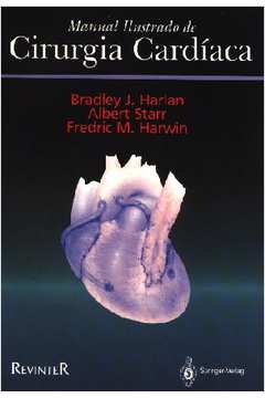 Manual Ilustrado de Cirurgia Cardíaca
