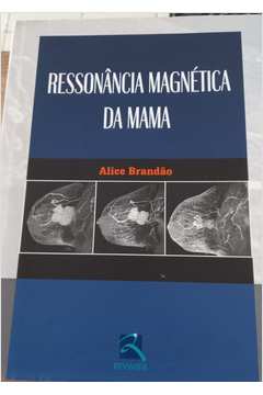 Ressonancia Magnetica da Mama