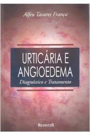 Urticária e Angioedema: Diagnóstico e Tratamento