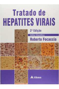 Tratado de Hepatites Virais