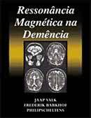 Ressonancia Magnetica na Demencia