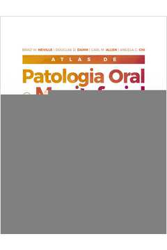 Atlas de patologia oral e maxilofacial