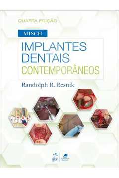 Misch - Implantes Dentais Contemporaneos - 4ª Ed
