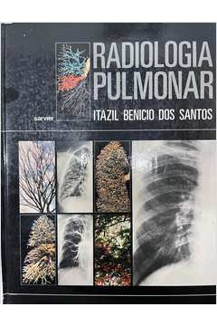 Radiologia Pulmonar